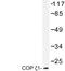 Coatomer Protein Complex Subunit Zeta 1 antibody, LS-C177448, Lifespan Biosciences, Western Blot image 