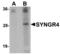 Synaptogyrin 4 antibody, TA306907, Origene, Western Blot image 