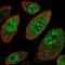 Myb/SANT DNA Binding Domain Containing 2 antibody, NBP1-93931, Novus Biologicals, Immunocytochemistry image 