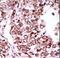 Calcium/Calmodulin Dependent Protein Kinase II Gamma antibody, LS-C100734, Lifespan Biosciences, Immunohistochemistry paraffin image 