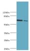 Amyloid Beta Precursor Like Protein 1 antibody, LS-C375223, Lifespan Biosciences, Western Blot image 