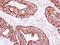 Caseinolytic Mitochondrial Matrix Peptidase Proteolytic Subunit antibody, GTX115070, GeneTex, Immunohistochemistry paraffin image 