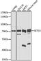 SET Domain Containing 3, Actin Histidine Methyltransferase antibody, GTX65538, GeneTex, Western Blot image 