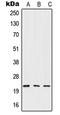 Interferon Beta 1 antibody, LS-C352352, Lifespan Biosciences, Western Blot image 