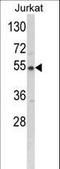 Branched Chain Keto Acid Dehydrogenase E1 Subunit Alpha antibody, LS-C156765, Lifespan Biosciences, Western Blot image 