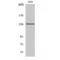 Glutamate Metabotropic Receptor 5 antibody, LS-C384527, Lifespan Biosciences, Western Blot image 