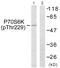 Ribosomal Protein S6 Kinase B2 antibody, PA5-38306, Invitrogen Antibodies, Western Blot image 