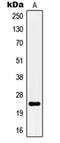 Potassium Calcium-Activated Channel Subfamily M Regulatory Beta Subunit 4 antibody, orb215140, Biorbyt, Western Blot image 