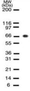 RB Transcriptional Corepressor 1 antibody, GTX13905, GeneTex, Western Blot image 