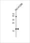 Cofilin 2 antibody, LS-C168707, Lifespan Biosciences, Western Blot image 