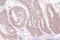 Desmoglein 2 antibody, A02035, Boster Biological Technology, Immunohistochemistry paraffin image 