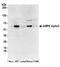 Protein Kinase AMP-Activated Catalytic Subunit Alpha 2 antibody, NB100-238, Novus Biologicals, Western Blot image 