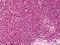 Protein Phosphatase 2 Scaffold Subunit Abeta antibody, orb95400, Biorbyt, Immunohistochemistry paraffin image 