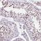 Zinc Finger Protein 3 antibody, NBP2-13545, Novus Biologicals, Immunohistochemistry paraffin image 