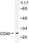 CD40 Molecule antibody, LS-C176334, Lifespan Biosciences, Western Blot image 