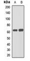 Anti-Mullerian Hormone Receptor Type 2 antibody, orb412459, Biorbyt, Western Blot image 