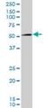 Alpha-Methylacyl-CoA Racemase antibody, H00023600-M02, Novus Biologicals, Western Blot image 