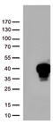 MAX Dimerization Protein MLX antibody, M03087, Boster Biological Technology, Western Blot image 