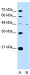 Solute Carrier Family 16 Member 1 antibody, TA334044, Origene, Western Blot image 