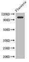Rho GTPase Activating Protein 42 antibody, CSB-PA413088LA01HU, Cusabio, Western Blot image 