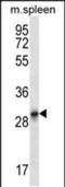 Keratin 222 antibody, PA5-48425, Invitrogen Antibodies, Western Blot image 