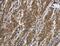 Interleukin 12 Receptor Subunit Beta 2 antibody, LS-C403238, Lifespan Biosciences, Immunohistochemistry frozen image 