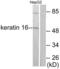 Keratin 16 antibody, LS-B7609, Lifespan Biosciences, Western Blot image 