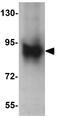 Axin 2 antibody, GTX31822, GeneTex, Western Blot image 