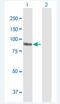 Plakophilin 3 antibody, H00011187-B01P-50ug, Novus Biologicals, Western Blot image 