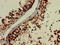 NOG antibody, LS-C678834, Lifespan Biosciences, Immunohistochemistry paraffin image 