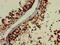 Noggin antibody, LS-C678834, Lifespan Biosciences, Immunohistochemistry paraffin image 