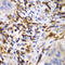 Hematopoietic Cell-Specific Lyn Substrate 1 antibody, LS-C331948, Lifespan Biosciences, Immunohistochemistry frozen image 