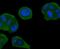 SMAD Family Member 4 antibody, NBP2-67372, Novus Biologicals, Immunocytochemistry image 