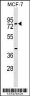 TOX high mobility group box family member 4 antibody, 59-365, ProSci, Western Blot image 