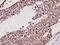 Inhibitor Of Nuclear Factor Kappa B Kinase Regulatory Subunit Gamma antibody, A00874-3, Boster Biological Technology, Immunohistochemistry frozen image 