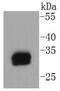 Tryptase Beta 2 (Gene/Pseudogene) antibody, NBP2-67608, Novus Biologicals, Western Blot image 