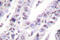 X-Ray Repair Cross Complementing 5 antibody, LS-C176287, Lifespan Biosciences, Immunohistochemistry paraffin image 