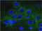 Spectrin Alpha, Non-Erythrocytic 1 antibody, NBP1-92689, Novus Biologicals, Immunocytochemistry image 