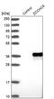 Zinc Finger CCHC-Type Containing 9 antibody, PA5-58379, Invitrogen Antibodies, Western Blot image 