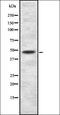 SET And MYND Domain Containing 2 antibody, orb337409, Biorbyt, Western Blot image 