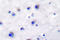 Neurotrophic Receptor Tyrosine Kinase 2 antibody, LS-C176307, Lifespan Biosciences, Immunohistochemistry paraffin image 