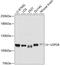 Ubiquitin Specific Peptidase 28 antibody, GTX66058, GeneTex, Western Blot image 