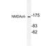 Glutamate Ionotropic Receptor NMDA Type Subunit 2D antibody, LS-C177843, Lifespan Biosciences, Western Blot image 