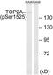 DNA Topoisomerase II Alpha antibody, PA5-39816, Invitrogen Antibodies, Western Blot image 