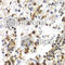 Staphylococcal Nuclease And Tudor Domain Containing 1 antibody, A5874, ABclonal Technology, Immunohistochemistry paraffin image 