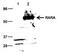 Retinoic Acid Receptor Alpha antibody, GTX60338, GeneTex, Western Blot image 