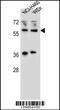WT1 Interacting Protein antibody, 56-070, ProSci, Western Blot image 