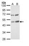 TSPY Like 1 antibody, PA5-22056, Invitrogen Antibodies, Western Blot image 