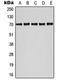 Activating Transcription Factor 2 antibody, orb213778, Biorbyt, Western Blot image 