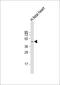 Zinc Finger DHHC-Type Containing 18 antibody, 61-320, ProSci, Western Blot image 